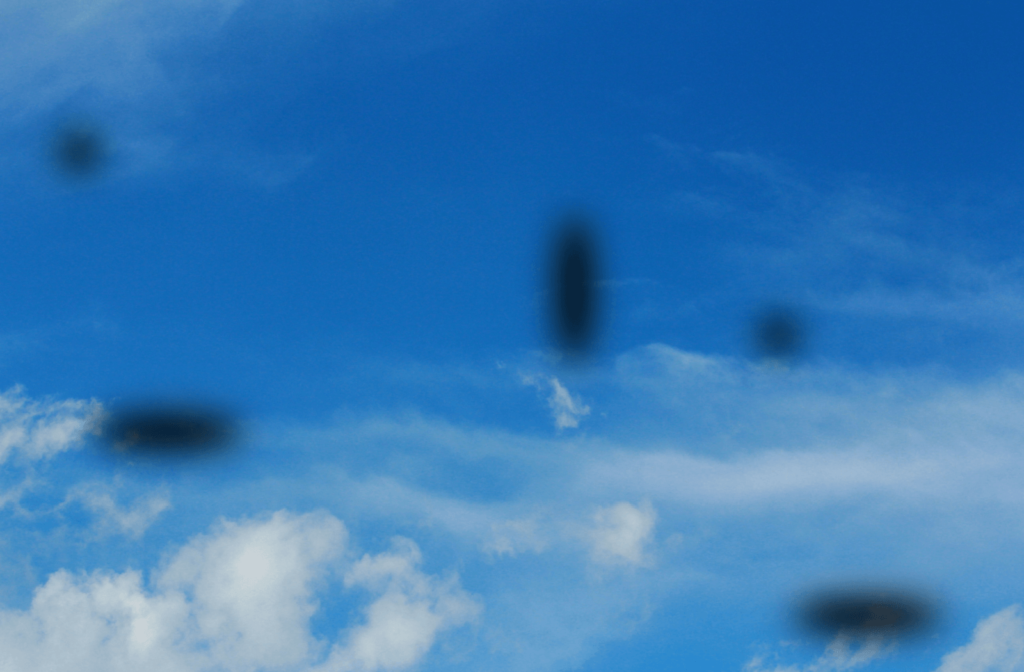 Visible black floaters blocking the view of the blue sky